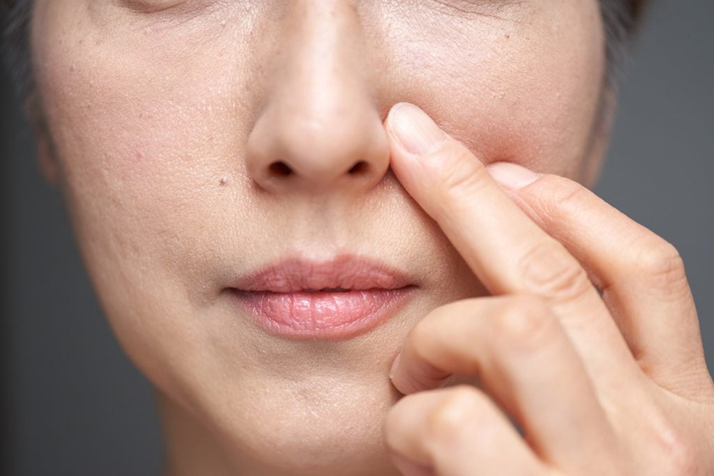 Zákrok může vyřešit přepadené tváře